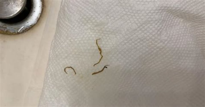 Are pinworms visible on toilet paper? check this out | what do pinworms look like on toilet paper