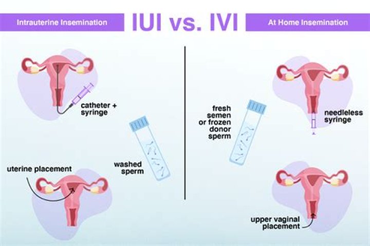 artificial insemination at home