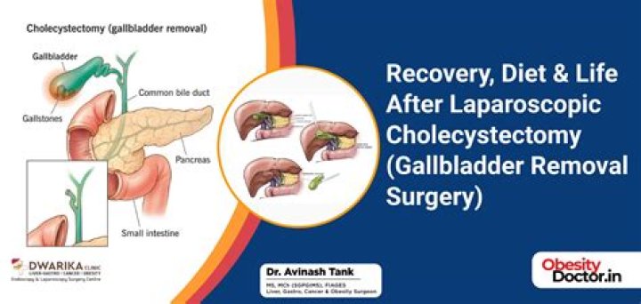 can you eat corn after gallbladder surgery