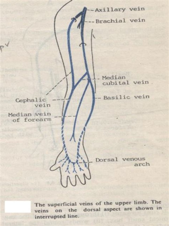 cephalic vein thrombosis