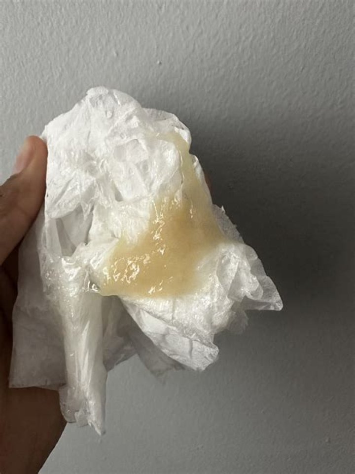clear jelly like discharge from bottom