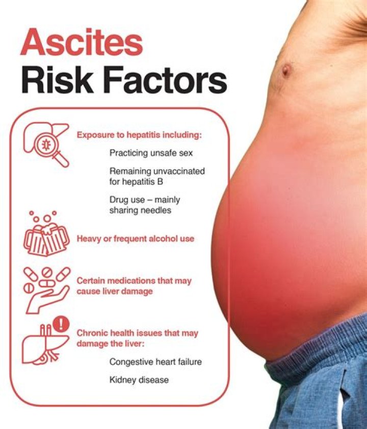 does ascites come and go