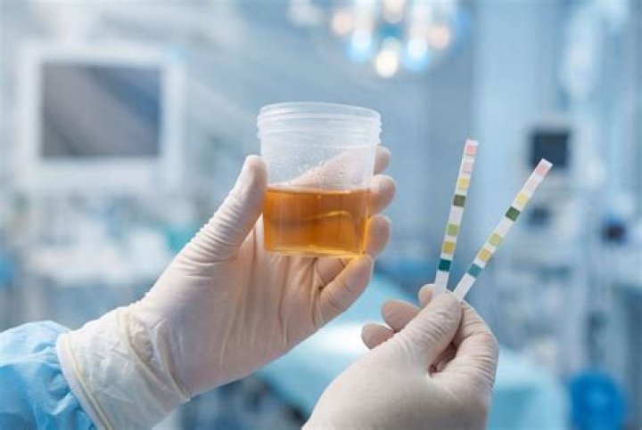 does labcorp test for synthetic urine 2021