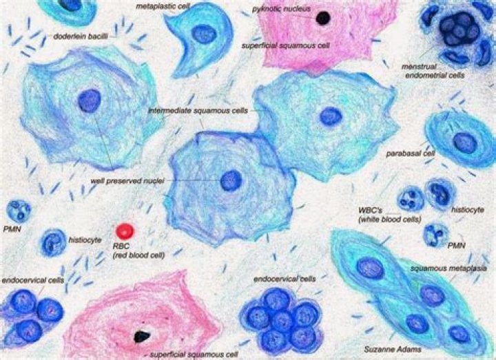 endocervical and or squamous metaplastic cells