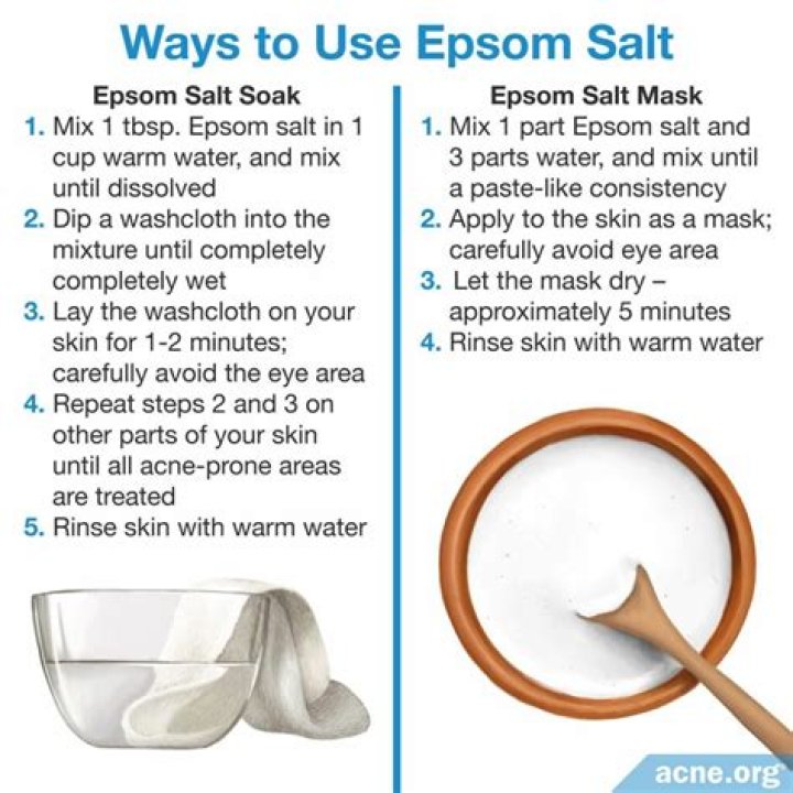 epsom salt for infection