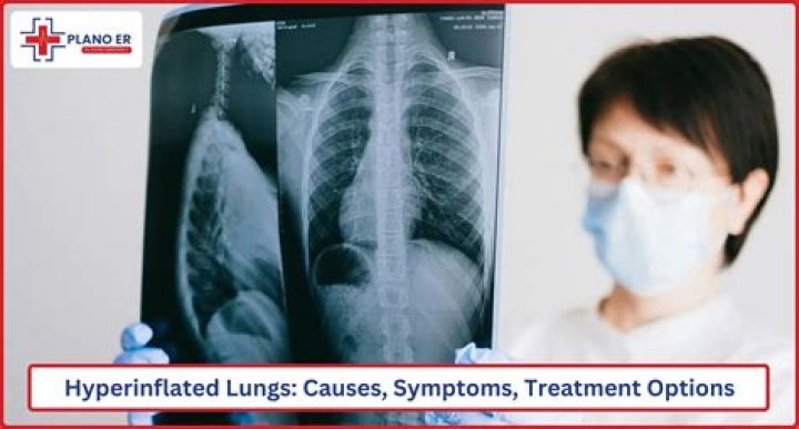 hyperinflated lungs life expectancy