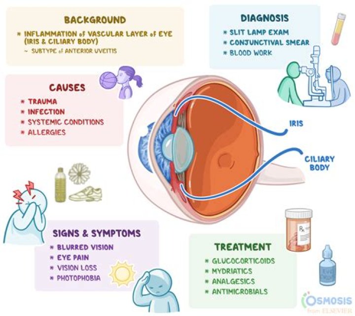 iridocyclitis definition