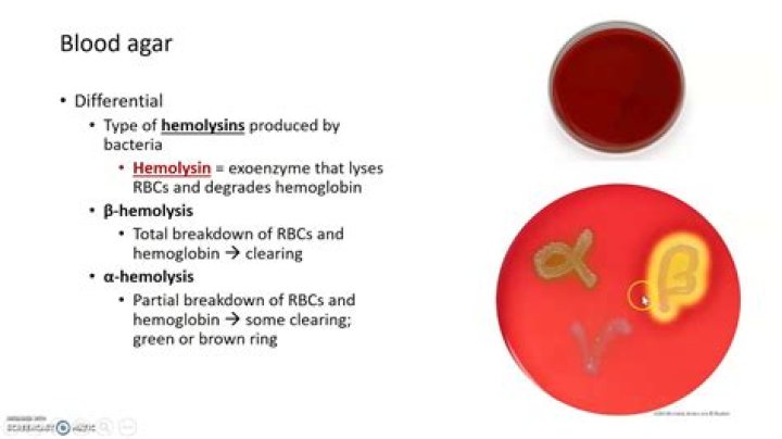 is blood agar selective or differential