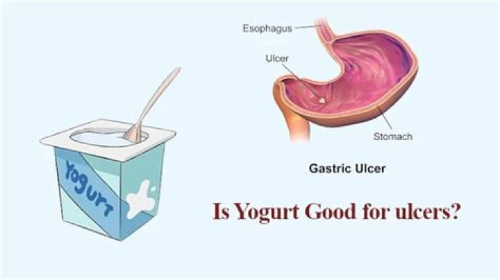 is yogurt good for ulcers