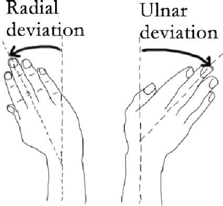 radial deviation of wrist