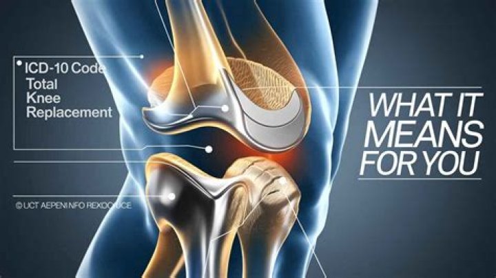 right total knee arthroplasty icd 10