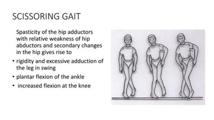 scissor gait