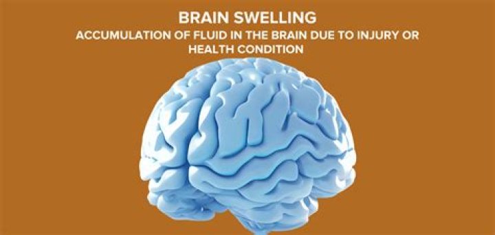 what causes swelling of the brain