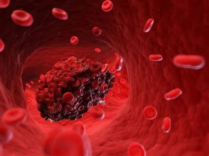 what does blood clot mean in jamaican