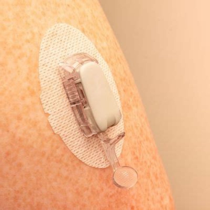 what insurance covers dexcom g6